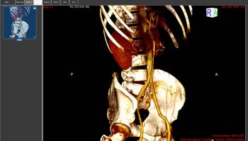 ORPALIS DICOM Viewer Free screenshot