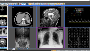 Sante DICOM Viewer Pro screenshot