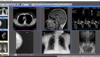 Sante DICOM Editor screenshot